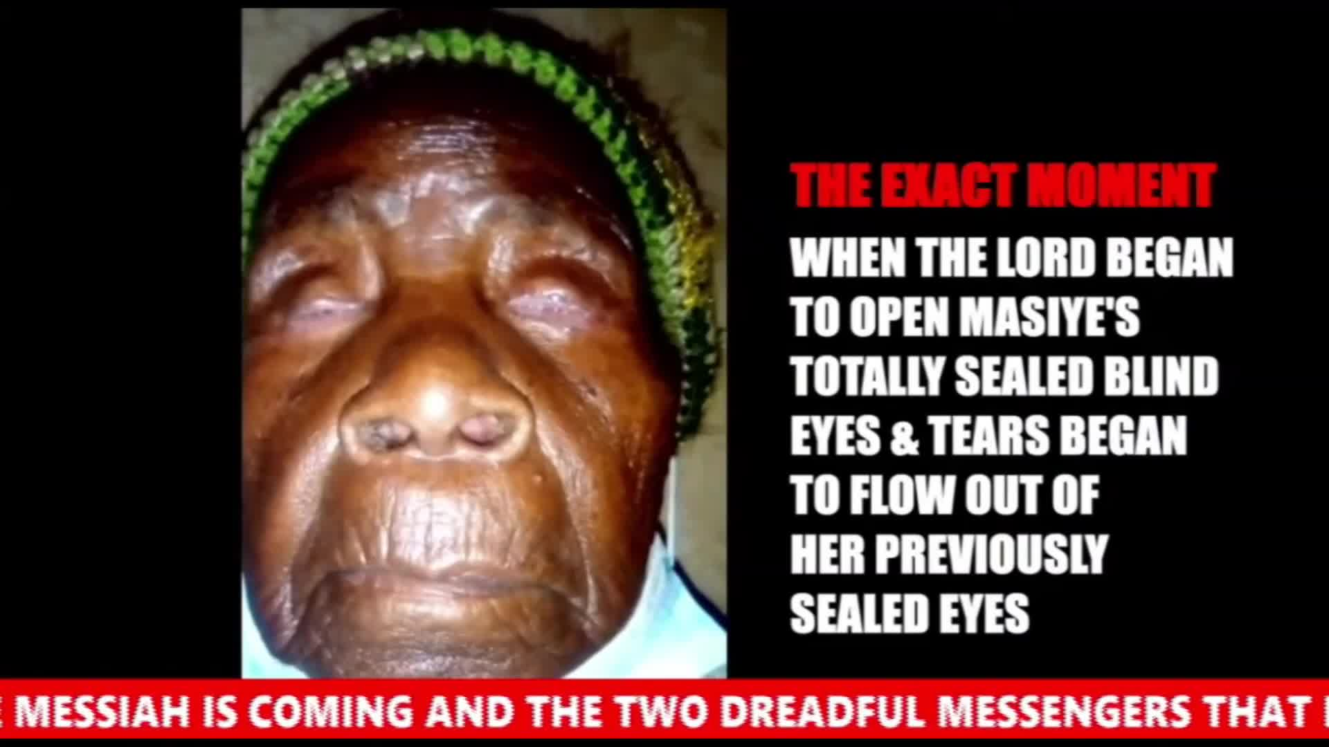 Thumbnail image for Prepare The Way, The Messiah Is Coming - Totally Blind Eyes Open In Zambia After 100 Years